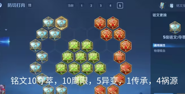 王者荣耀守约出装是什么